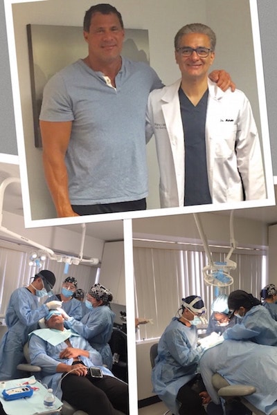 Before and During Jose Canseco's Hair Transplant Journey