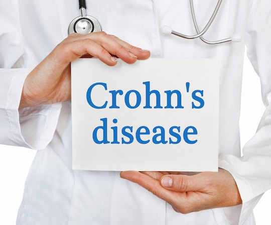 Crohn's Illness