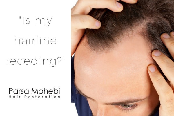 Receding Hairline how to tell