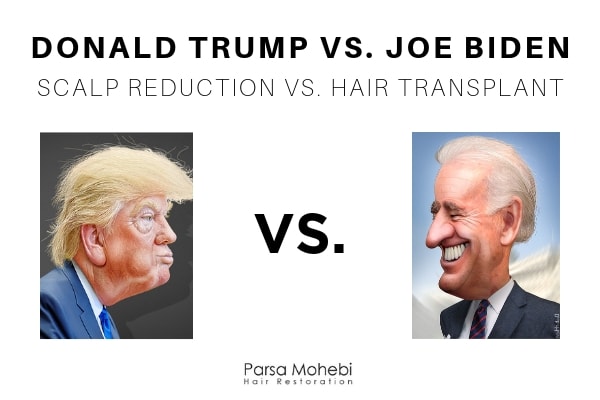 Donald Trump vs Joe Biden vs Scalp Reduction