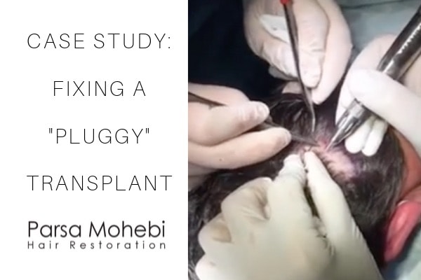 Hair Transplant Plug Repair