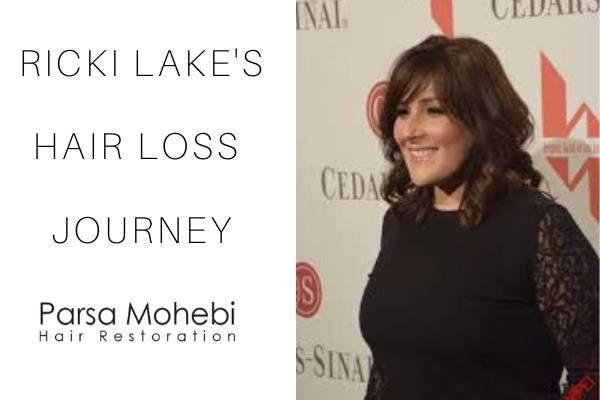 Ricki Lake Hair Loss Struggle