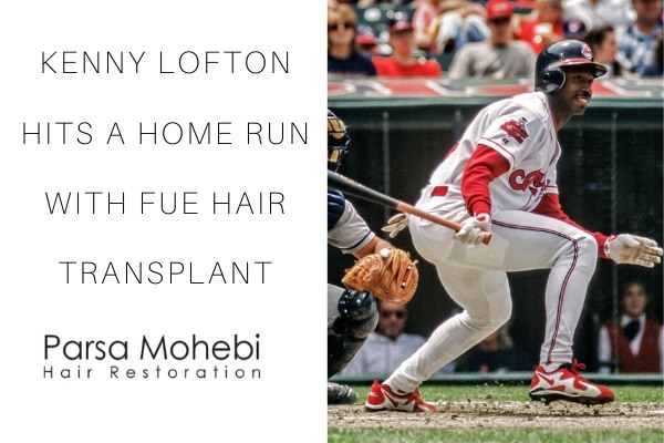 Kenny Lofton got fue hair transplant