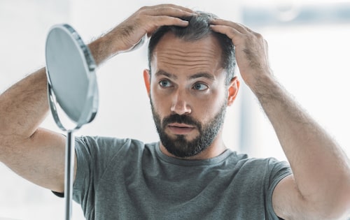 See the four facts you should know before a hair transplant