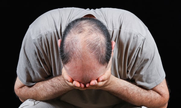 Cause of hair loss and how to fight it