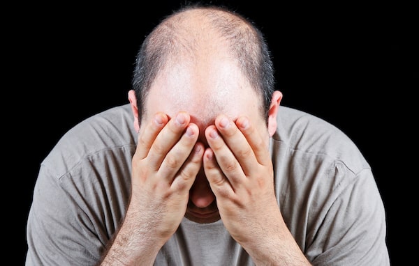 Hair loss connected to hair loss