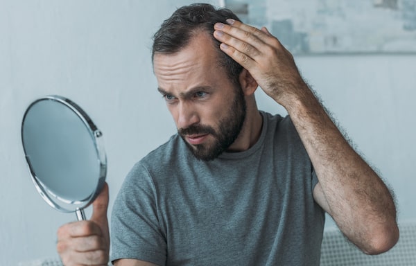 How to treat hair loss