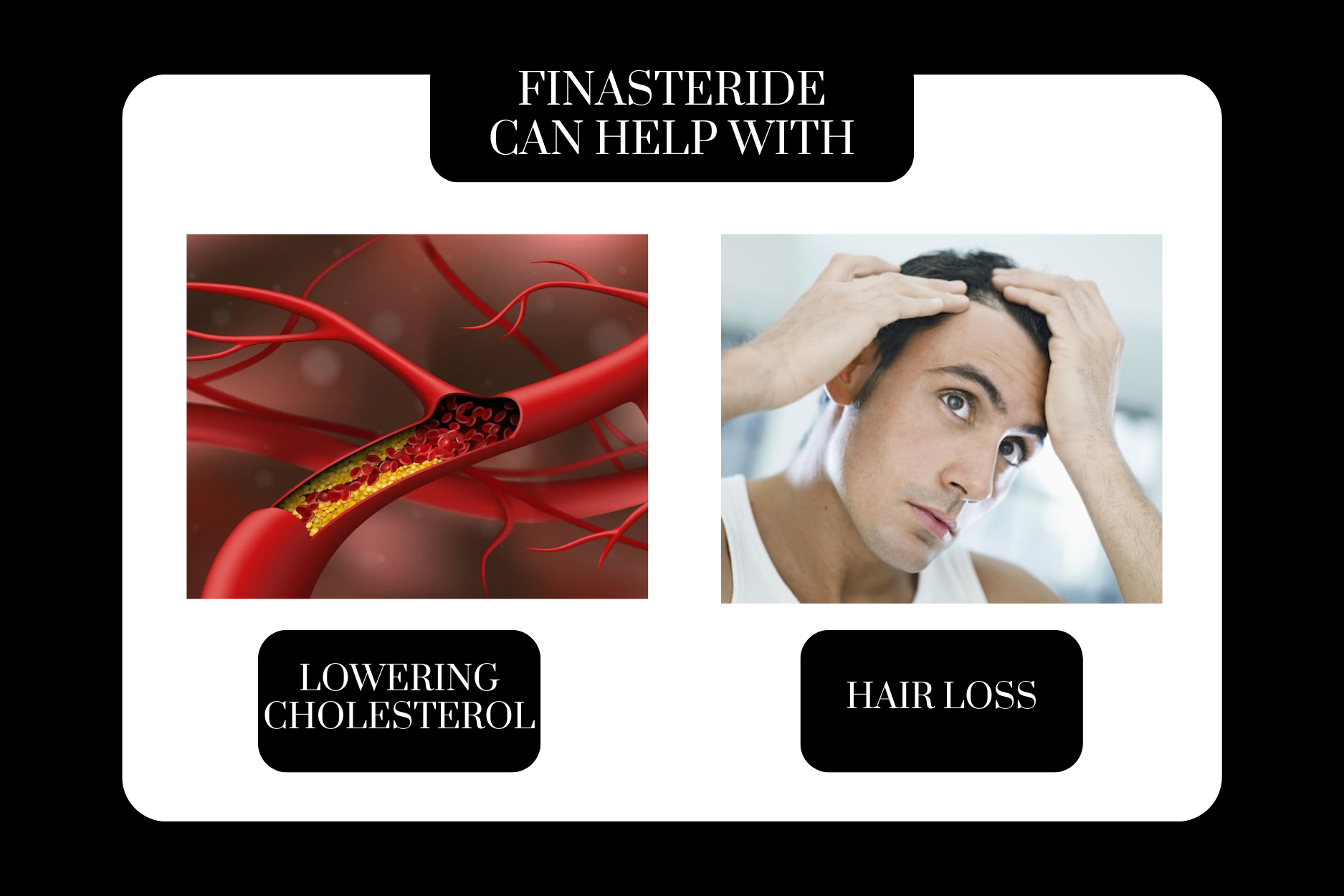 does finasteride lower cholesterol?